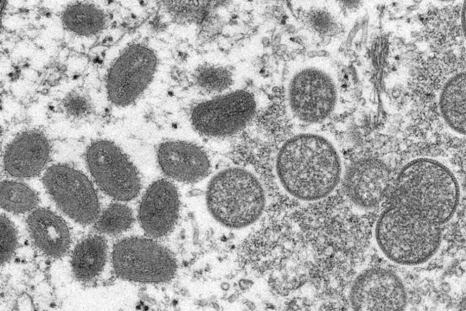 Apkoppevirus sett i elektronmikroskop Apkoppevirus sett i elektronmikroskop